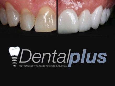 DENTAL PLUS SLP