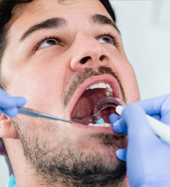 DENTAL PLUS SLP - Limpieza dental