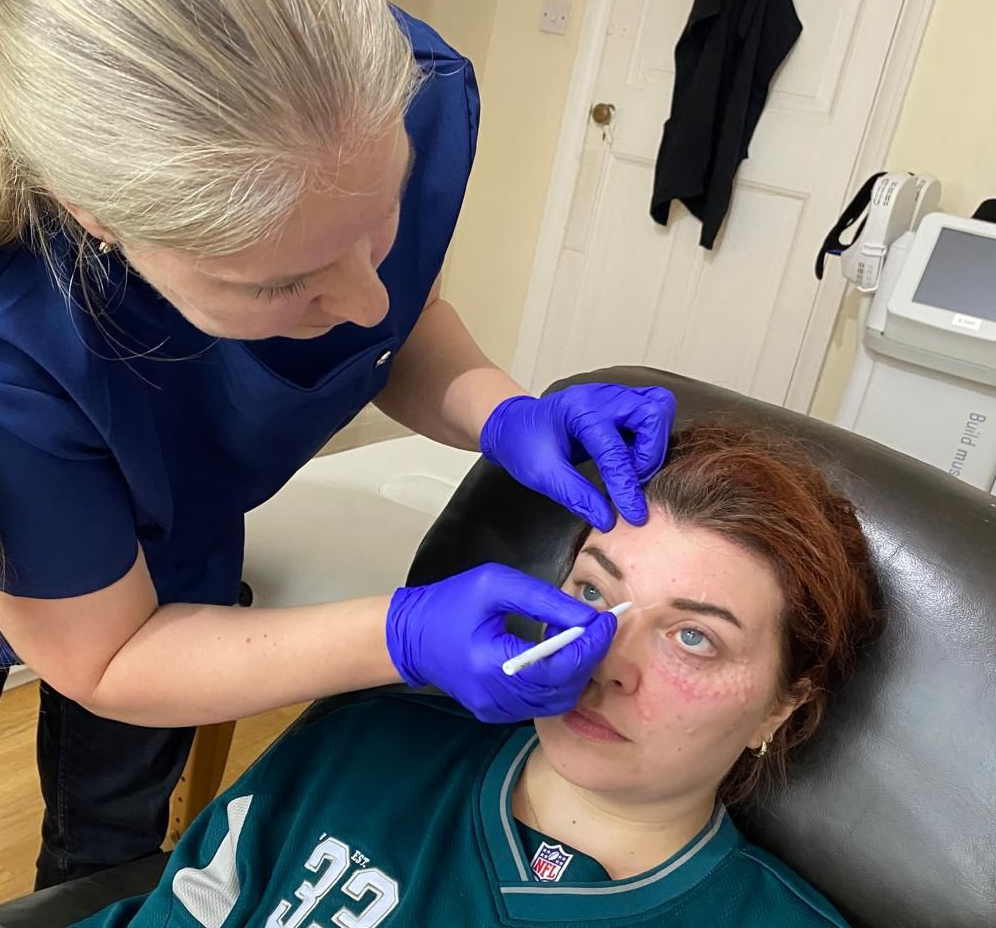 dermal fillers