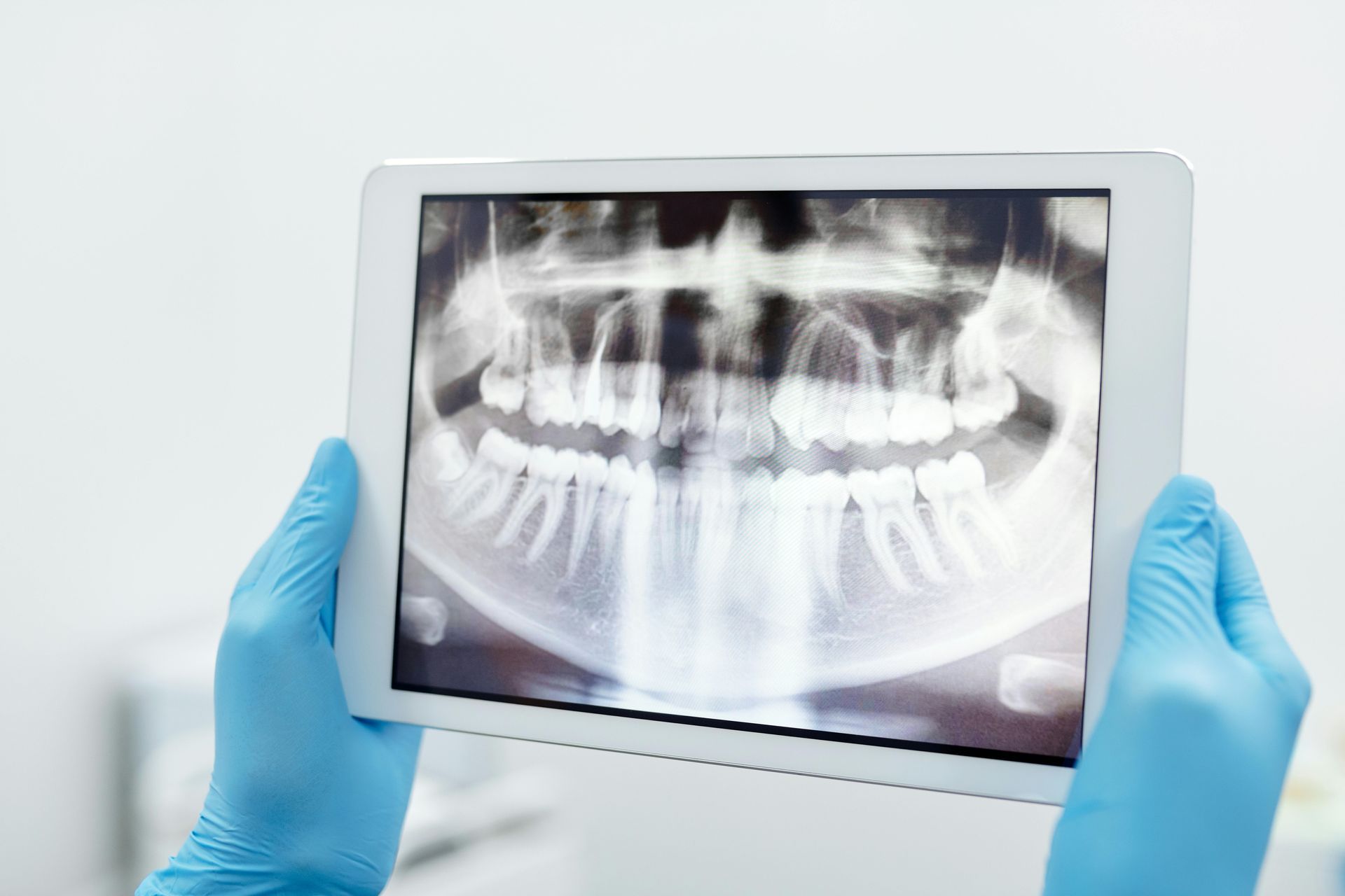 A person is holding a tablet with an x-ray of their teeth on it.