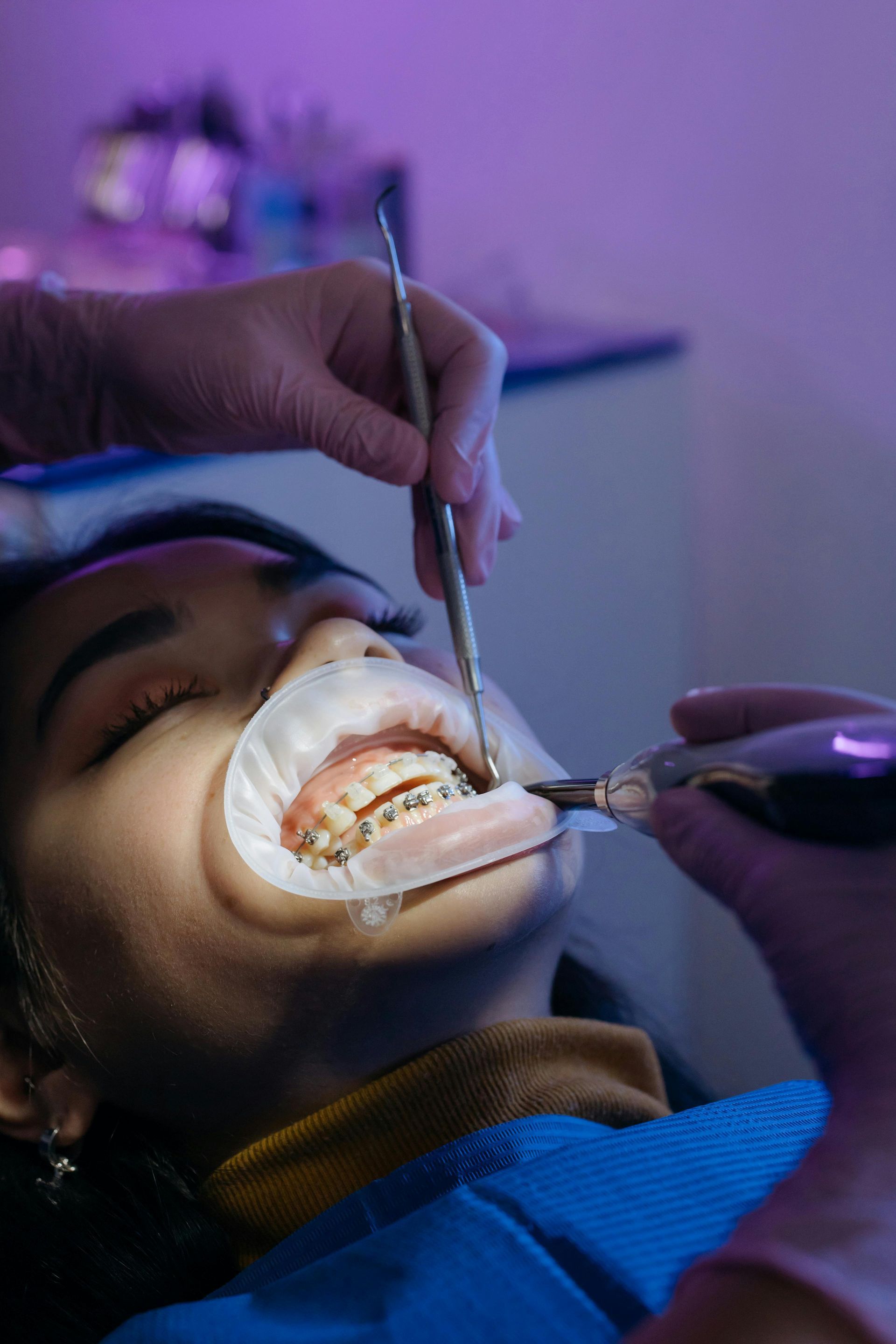 A woman is getting her teeth examined by a dentist.