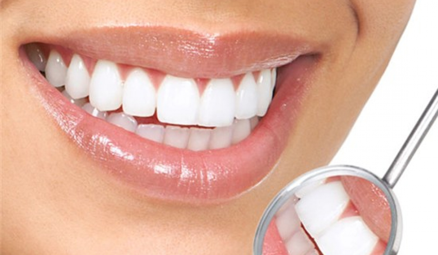 A close up of a woman 's smile with a dental mirror. Littleton, CO