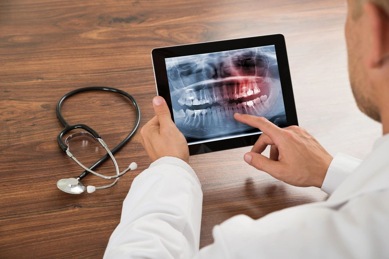 A doctor is looking at an x-ray of a person 's teeth on a tablet. Littleton, CO