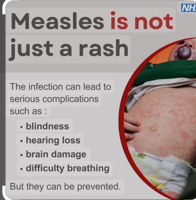 MMR Vaccination