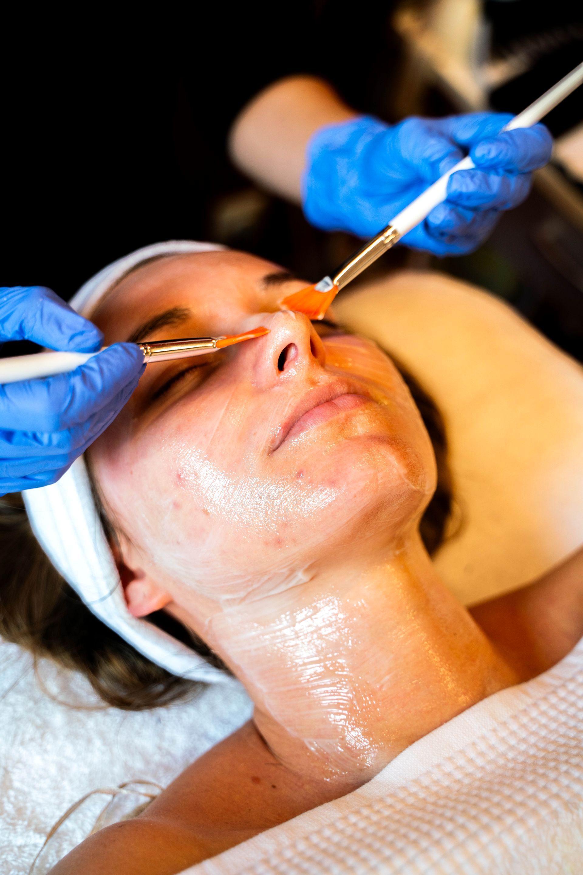 Chemische peeling bij Très Bo