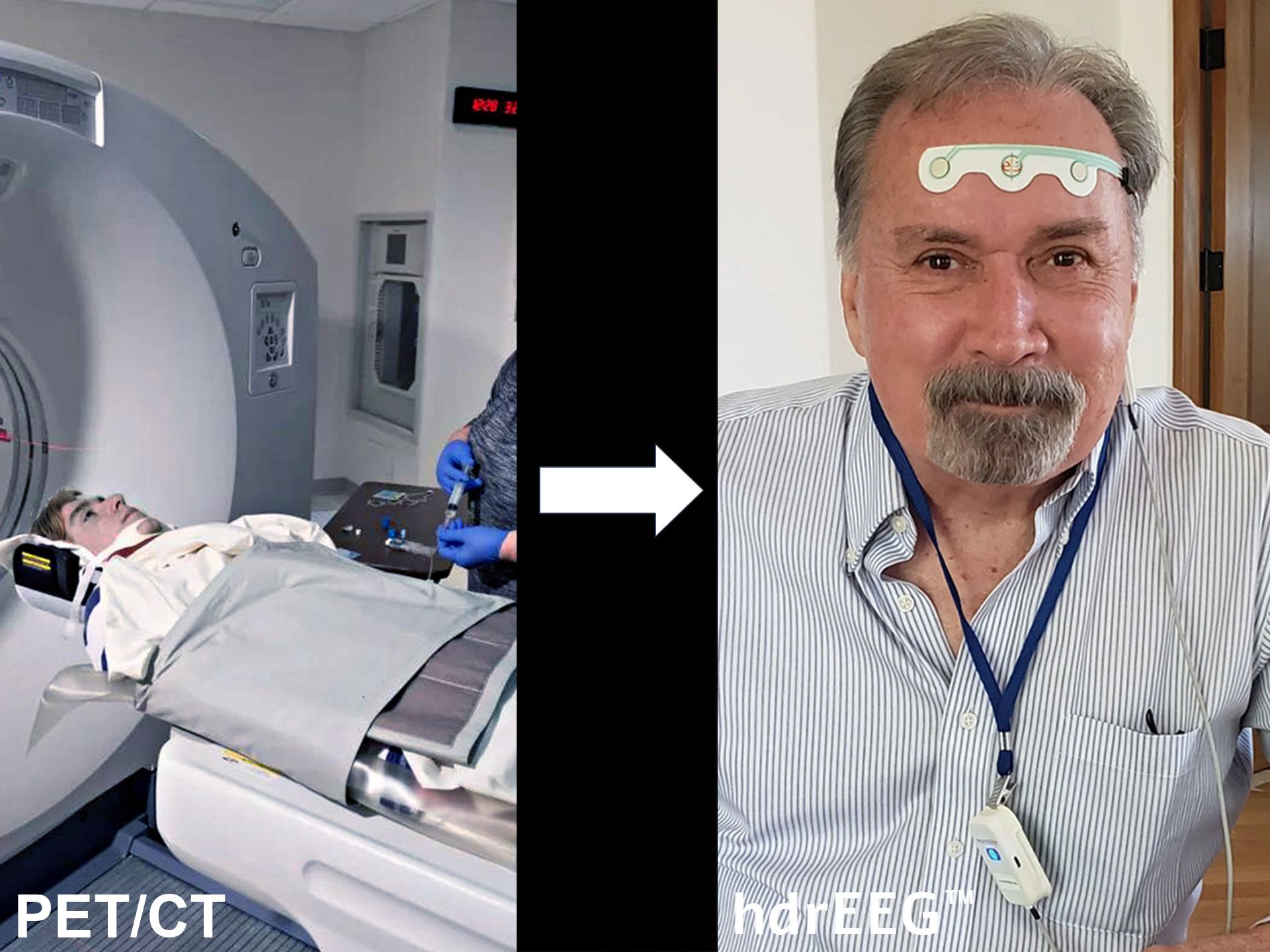 Evaluation of Parkinson’s Disease Early Diagnosis