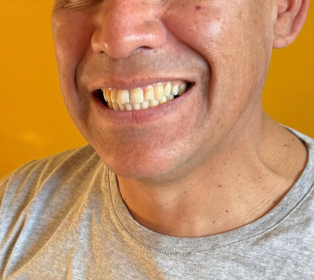 Hombre sonriendo, mostrando los dientes, con una camisa gris, sobre un fondo amarillo.