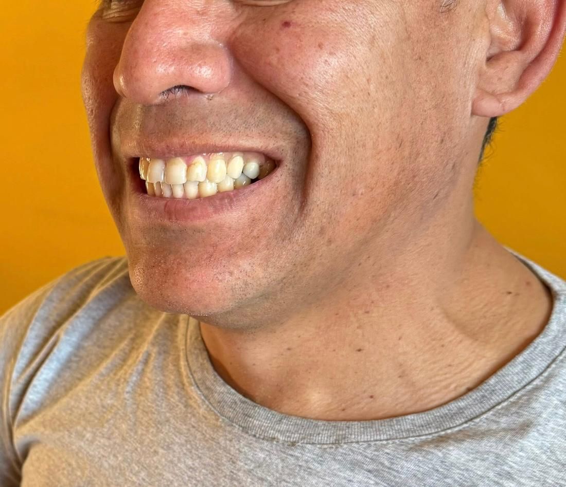 Hombre sonriendo, mostrando los dientes, con una camisa gris, sobre un fondo naranja.