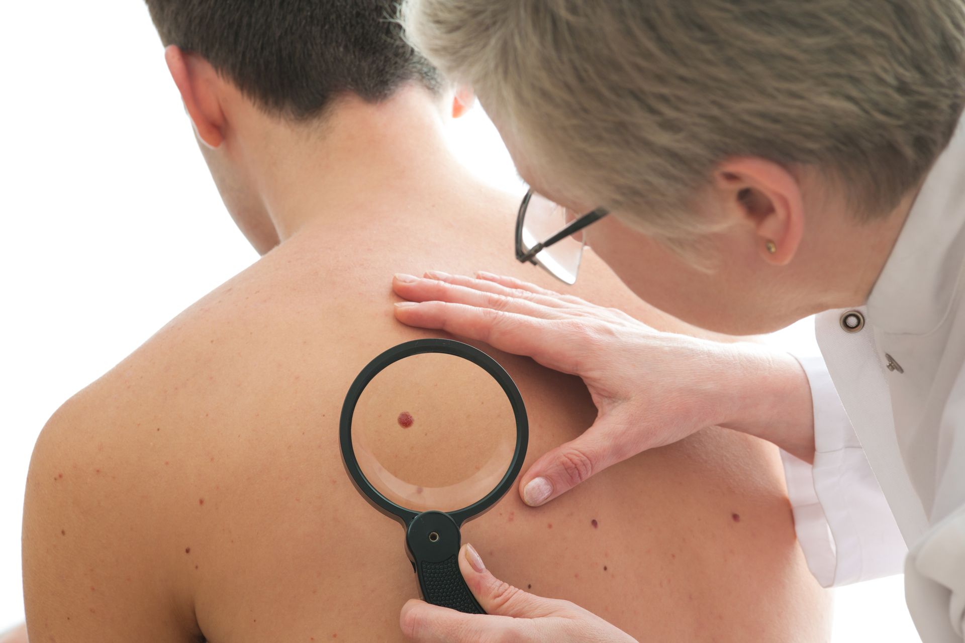 Dermatologist examines a mole of male patient | Lloyds Northside Clinic | Mackay 