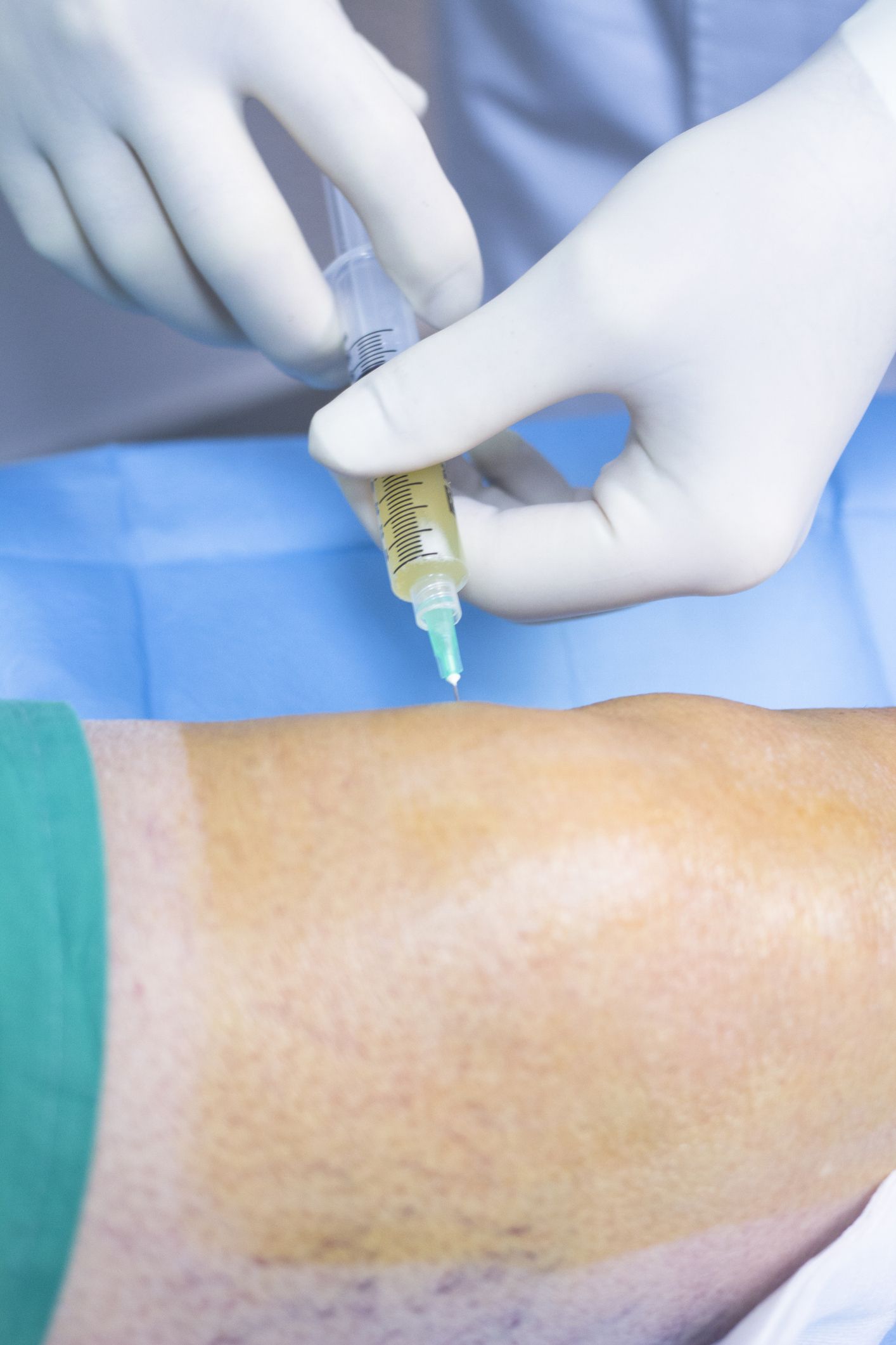terapia infiltrativa