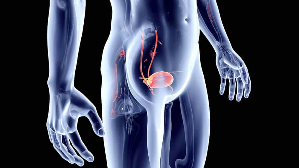 Dr. Thiago Vilela Castro Urologista Dr. Thiago Vilela Castro