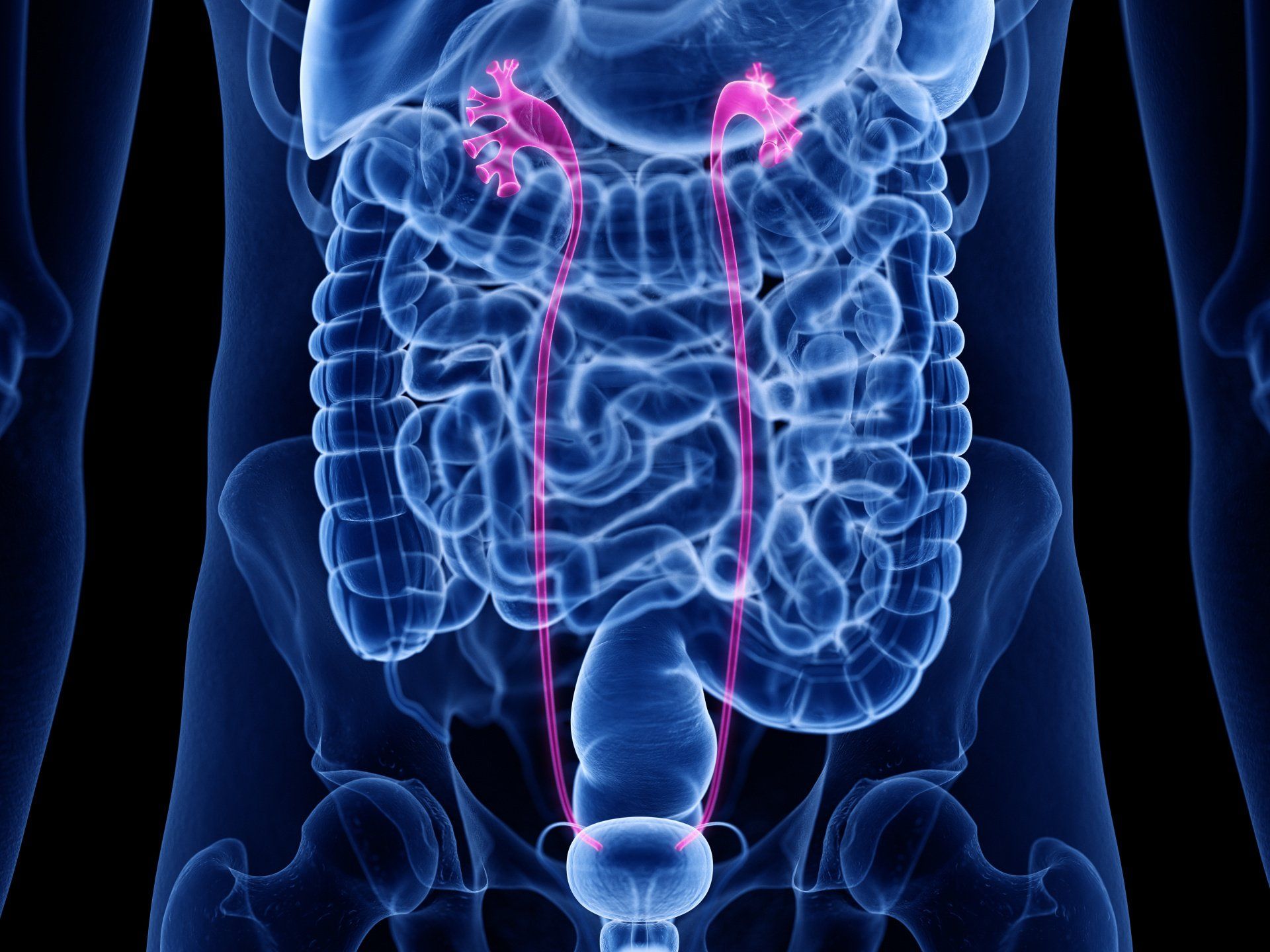 Tratamento para tumor de ureter em Brasília Tratamento para tumor de ureter em Brasília