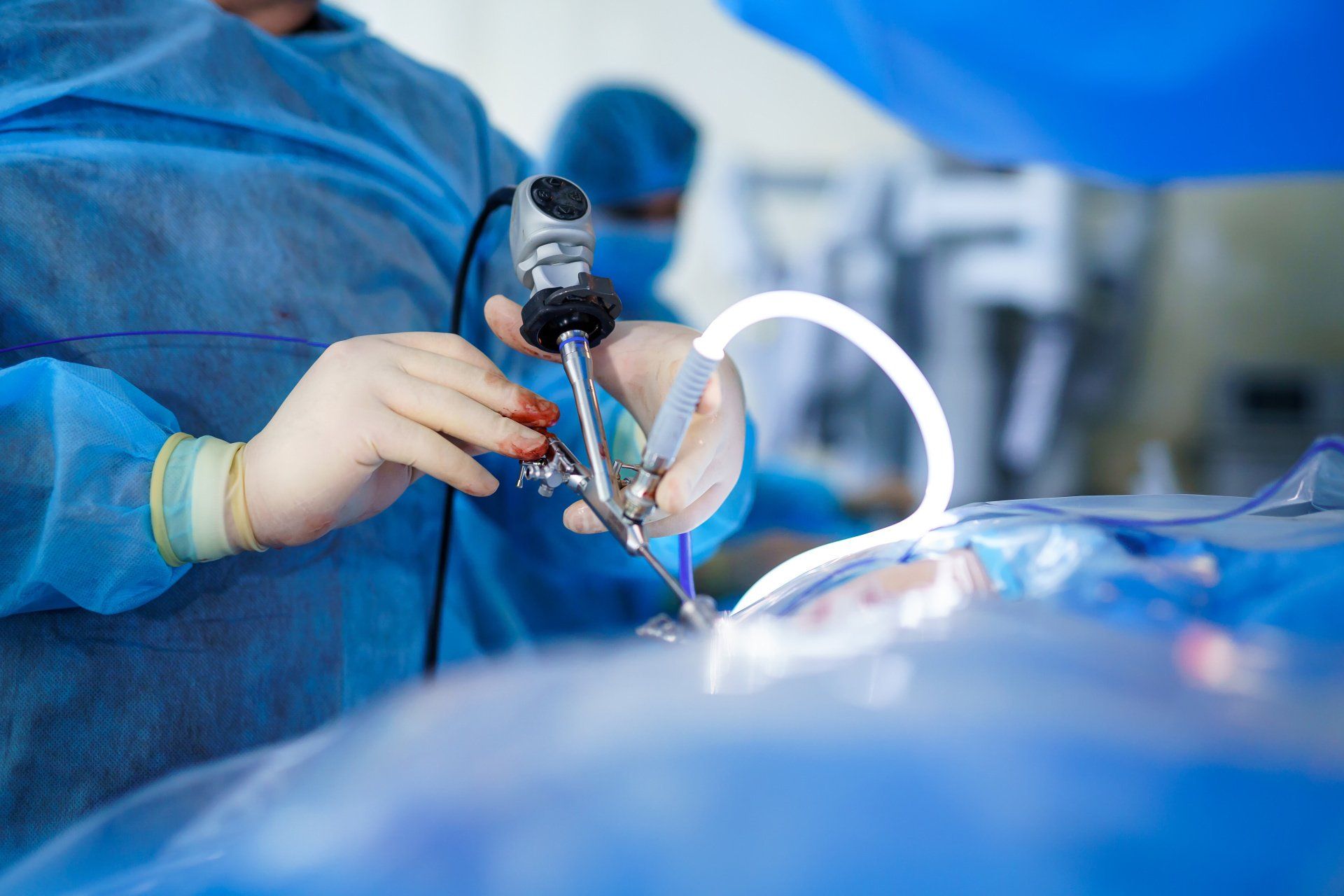 Como é feita a cirurgia robótica de rim Como é feita a cirurgia robótica de rim