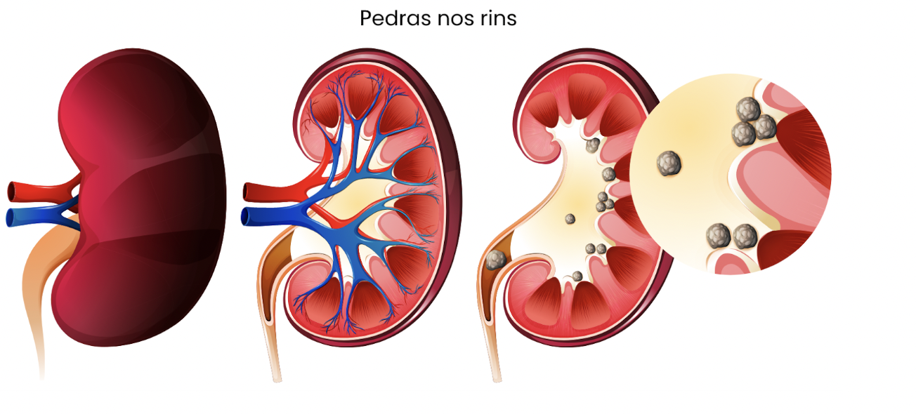 Exame de próstata Quando realizar o exame de próstata