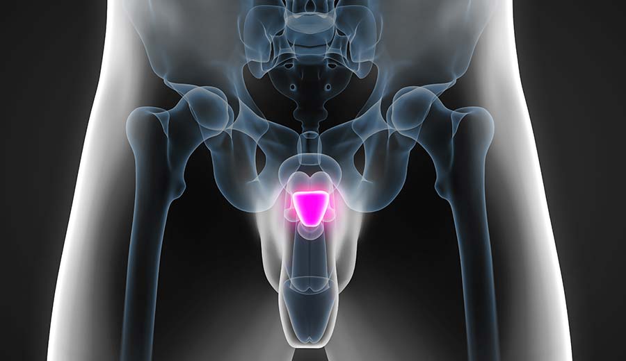 Dr. Thiago Vilela Castro Urologista Dr. Thiago Vilela Castro