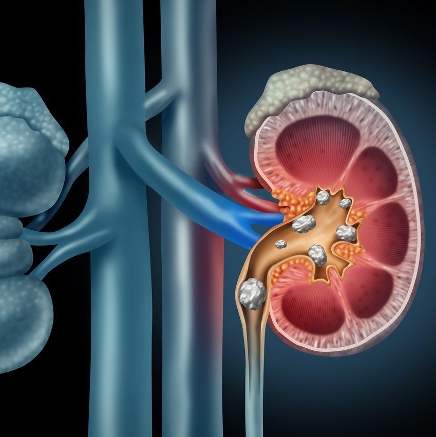 Dr. Thiago Vilela Castro Urologista Dr. Thiago Vilela Castro
