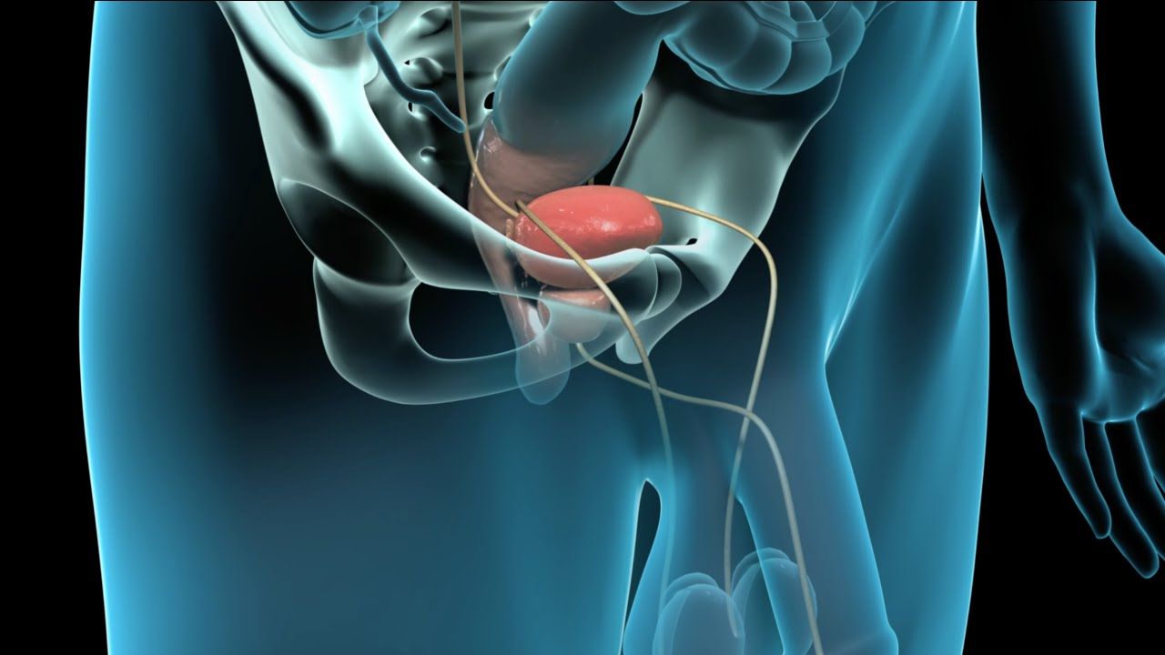 Dr. Thiago Vilela Castro Urologista Dr. Thiago Vilela Castro