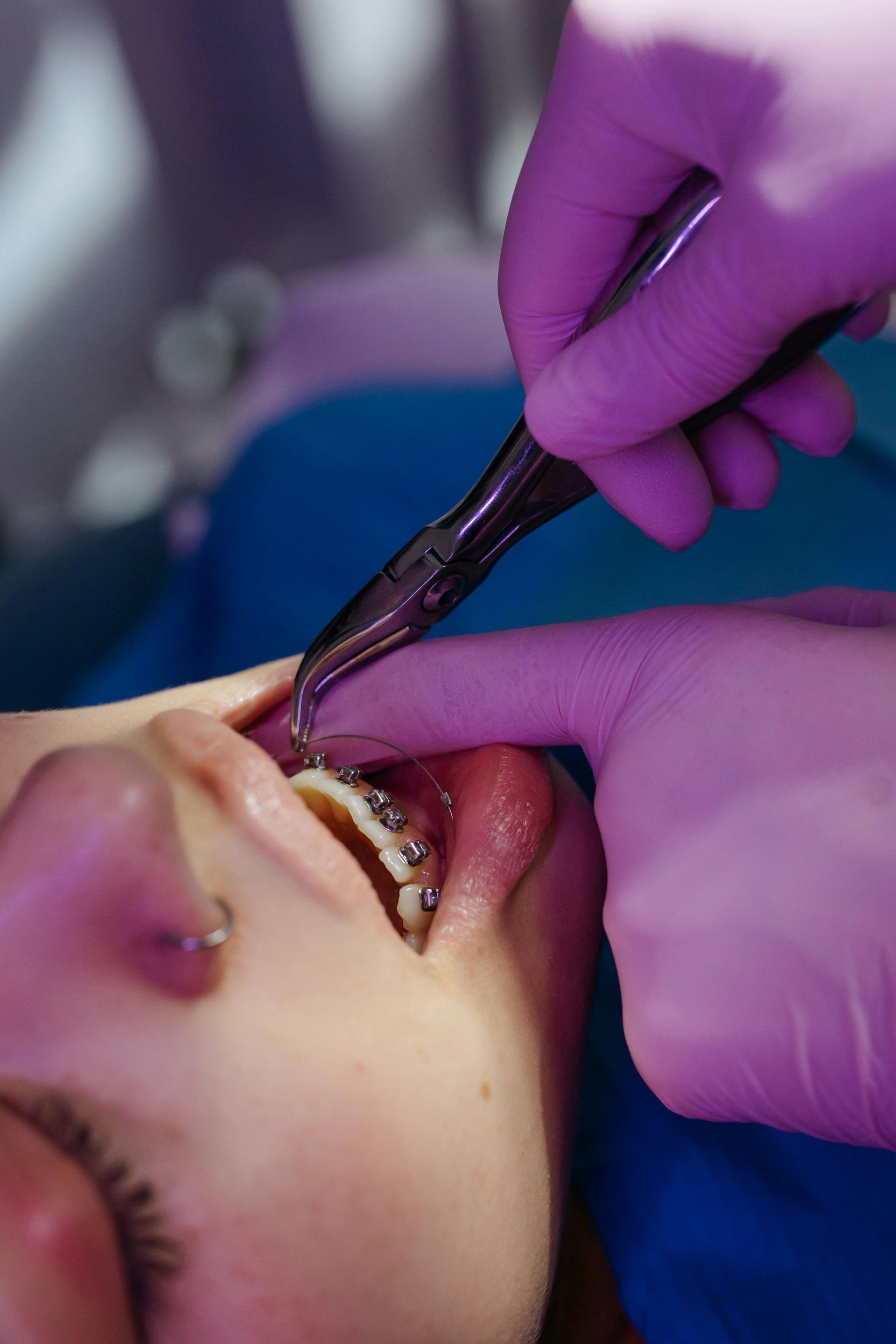 orthodontic treatment options for teens and adults in West Haven, UT