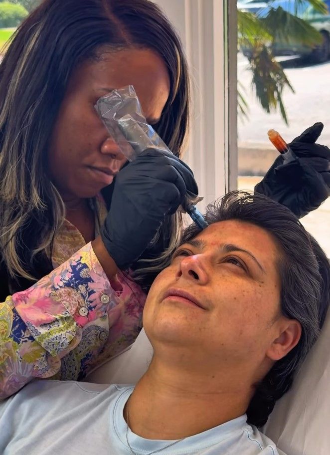 Person applying cosmetic treatment to another person's eyebrow with a needle, wearing black gloves.