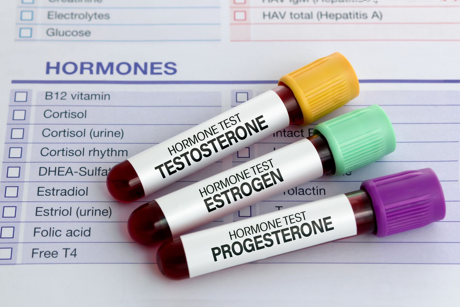 Blood test tubes labeled testosterone, estrogen, and progesterone on a hormones lab report.