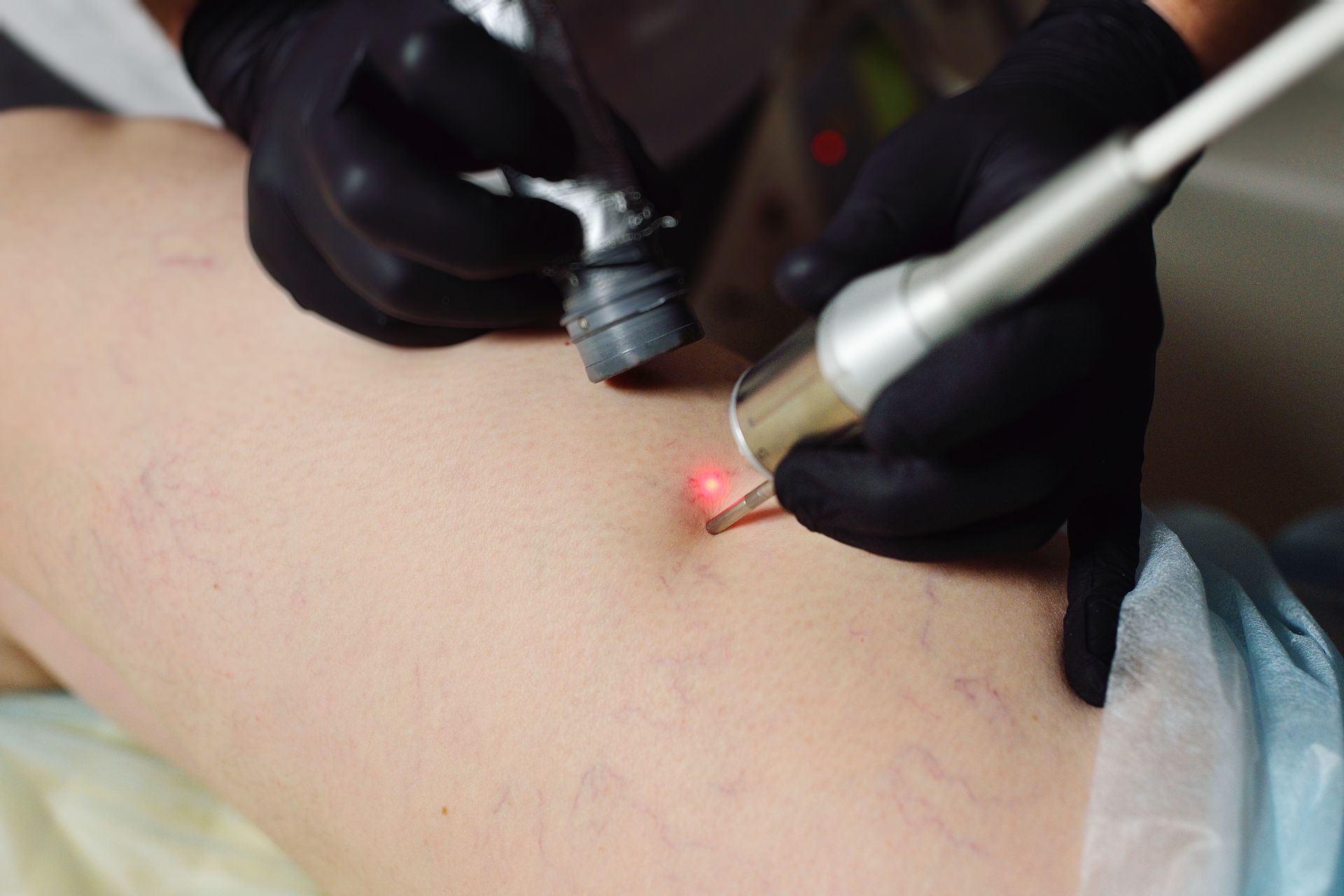 A person is getting a laser treatment on their leg.