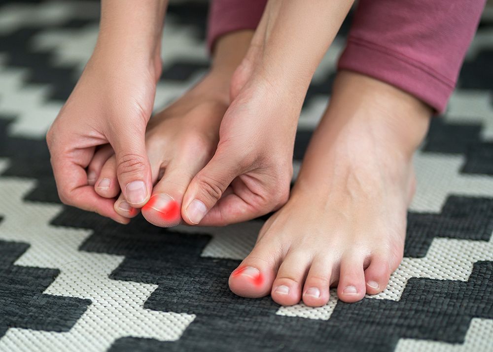 Ingrown Toenails