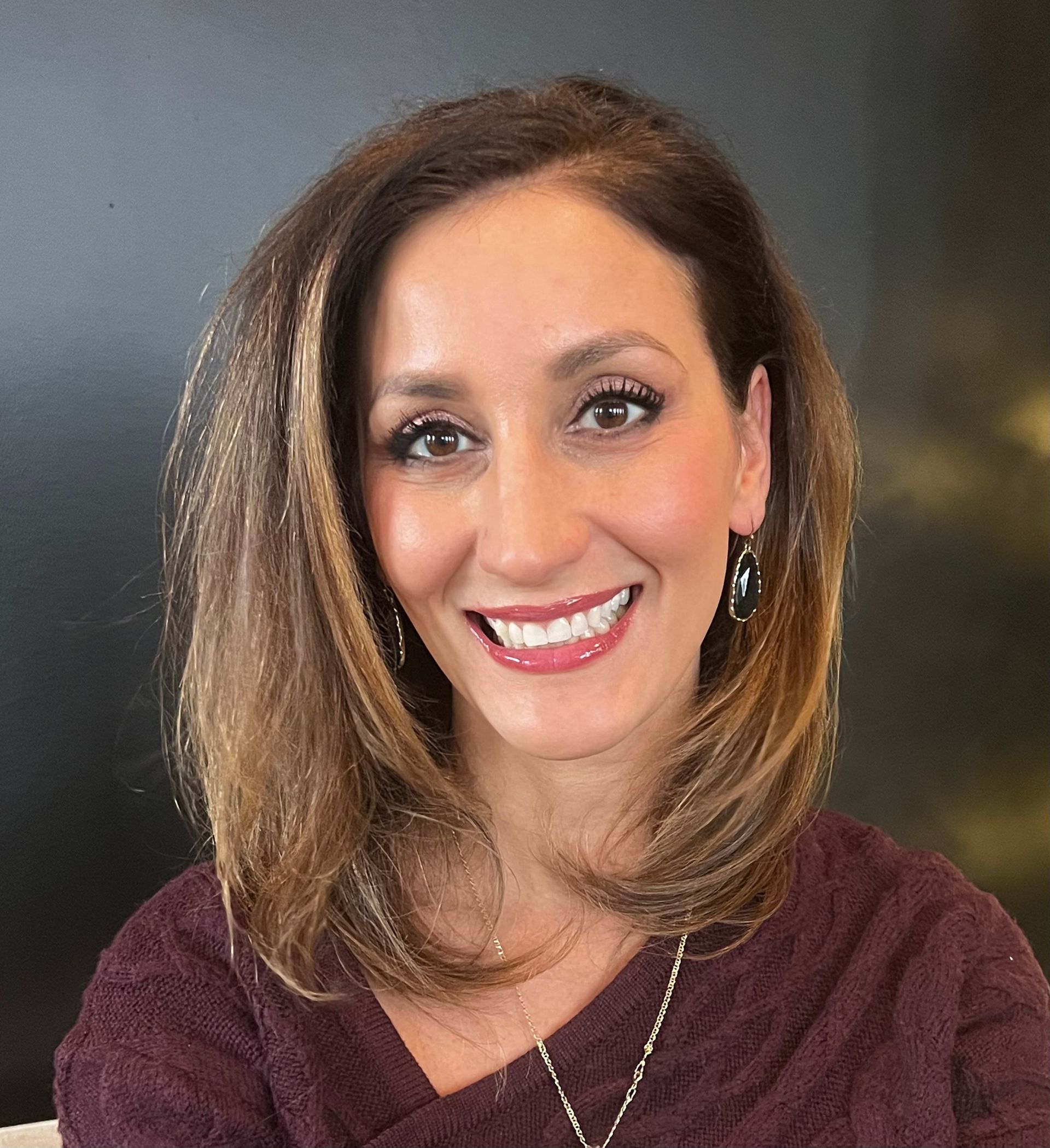 Fillings — Dr. Emily Karamagianis in Orland Park, IL Fillings — Dr. Emily Karamagianis in Orland Park, IL