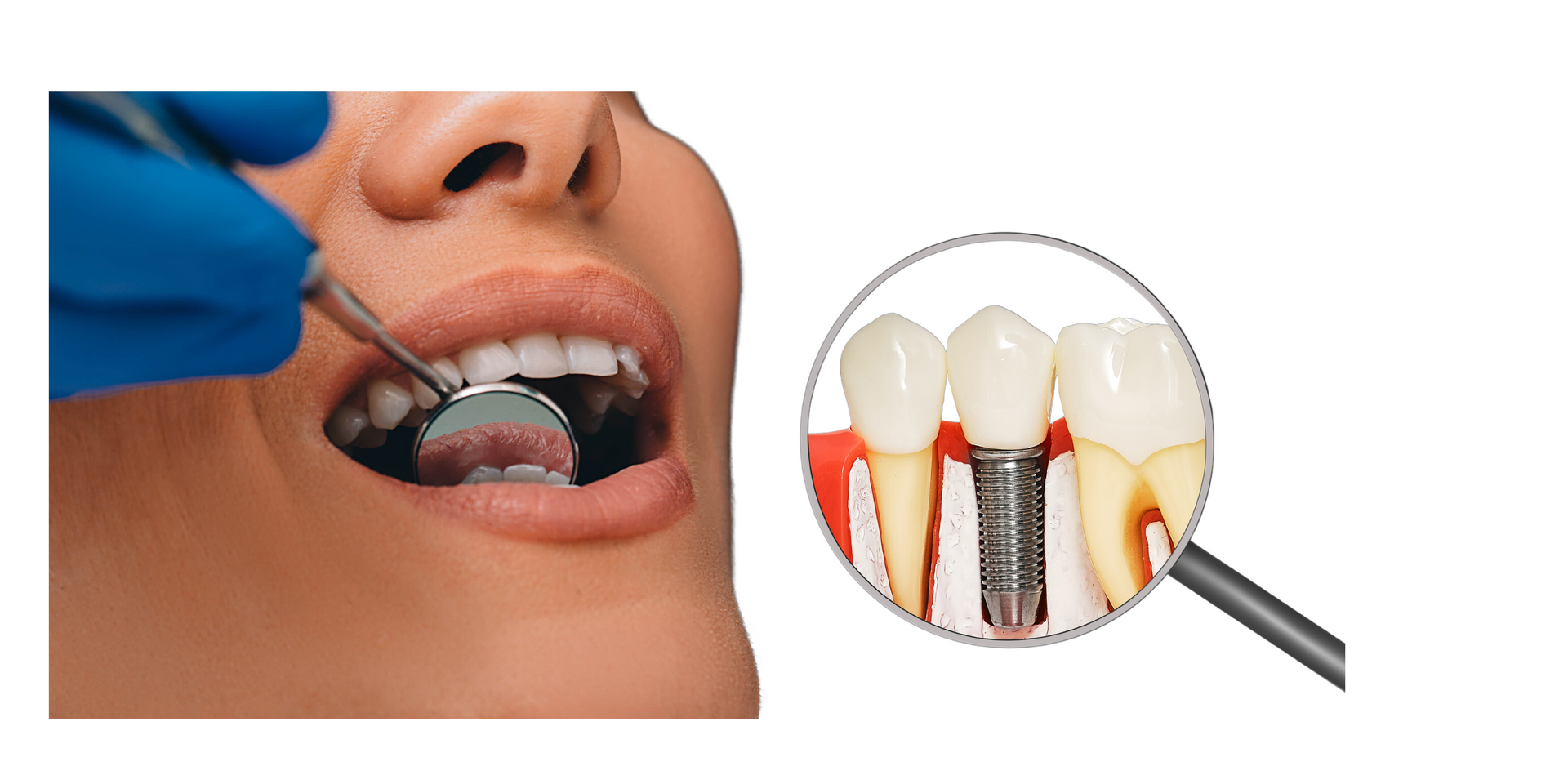 a woman is getting her teeth examined by a dentist .