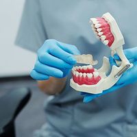 Gloved hands holding a dental model with pink gums and white teeth in a clinical setting