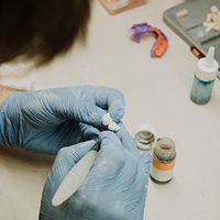 Gloved hands assembling a small dental impression mold beside tools and jars on a worktable