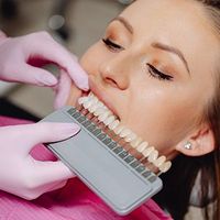 Dentist matching teeth shades with a patient using a color guide