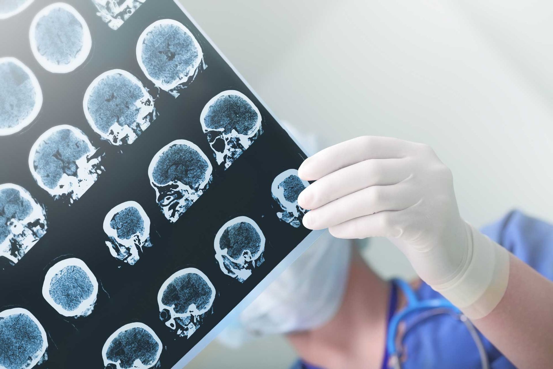 Gloved medical professional holding up a sheet of brain scan images for review. Gloved medical professional holding up a sheet of brain scan images for review.