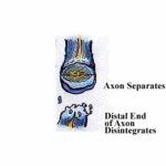 Disintegrate Axon — Omaha, NE — Law Office of Stephen L. Gerdes Disintegrate Axon — Omaha, NE — Law Office of Stephen L. Gerdes