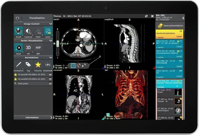medical device software user interface