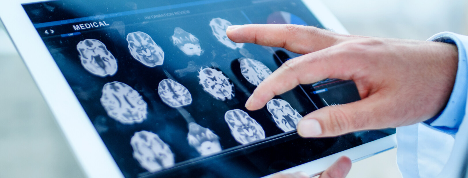doctor using a tablet looking at an X-ray