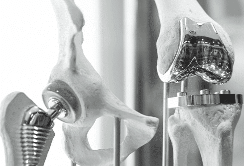 orthopedic implant picture