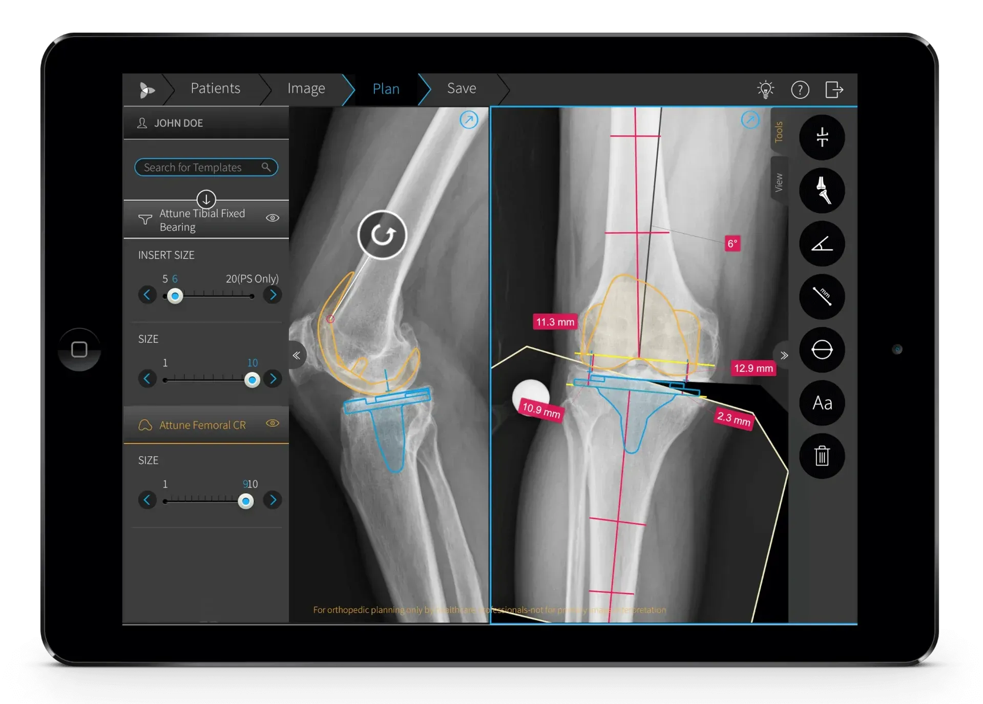 medical device