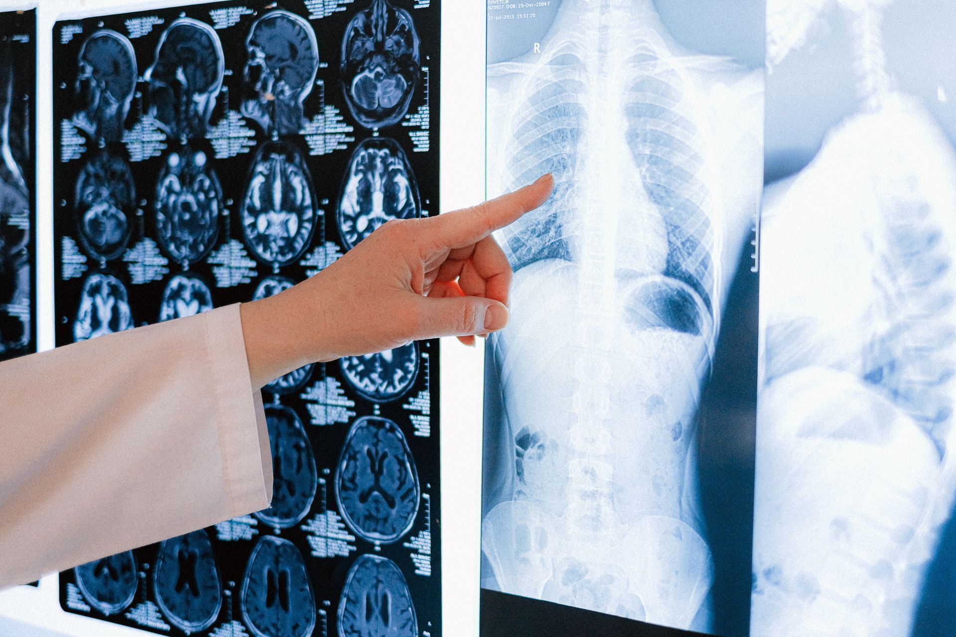 Doctor showing an X-ray image
