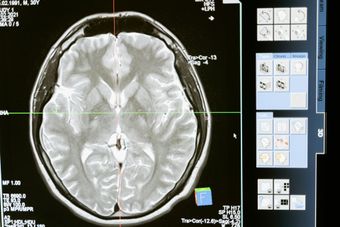 Brain CT scan