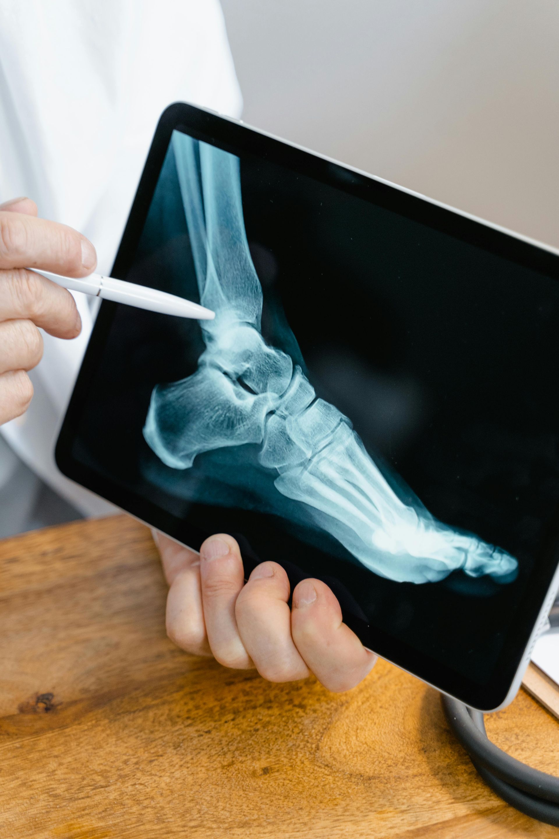 ipad showing an ankle X-ray