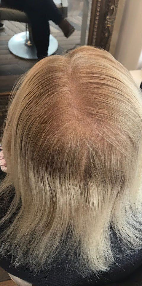 Hair loss solution by la bella vita in Belfast