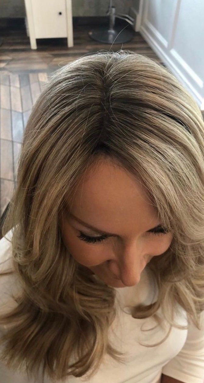 hair loss treatment by la bella vita in belfast