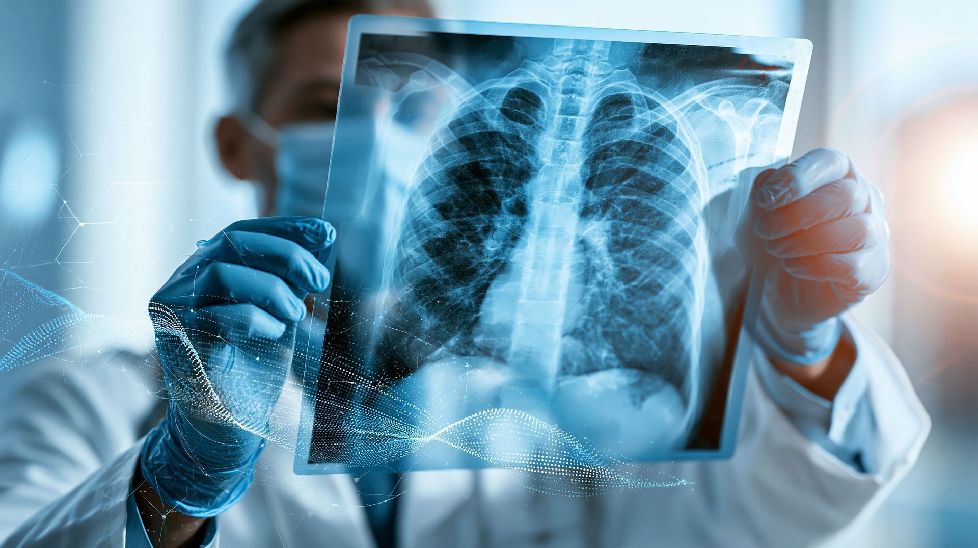 exames cirurgia pulmonar