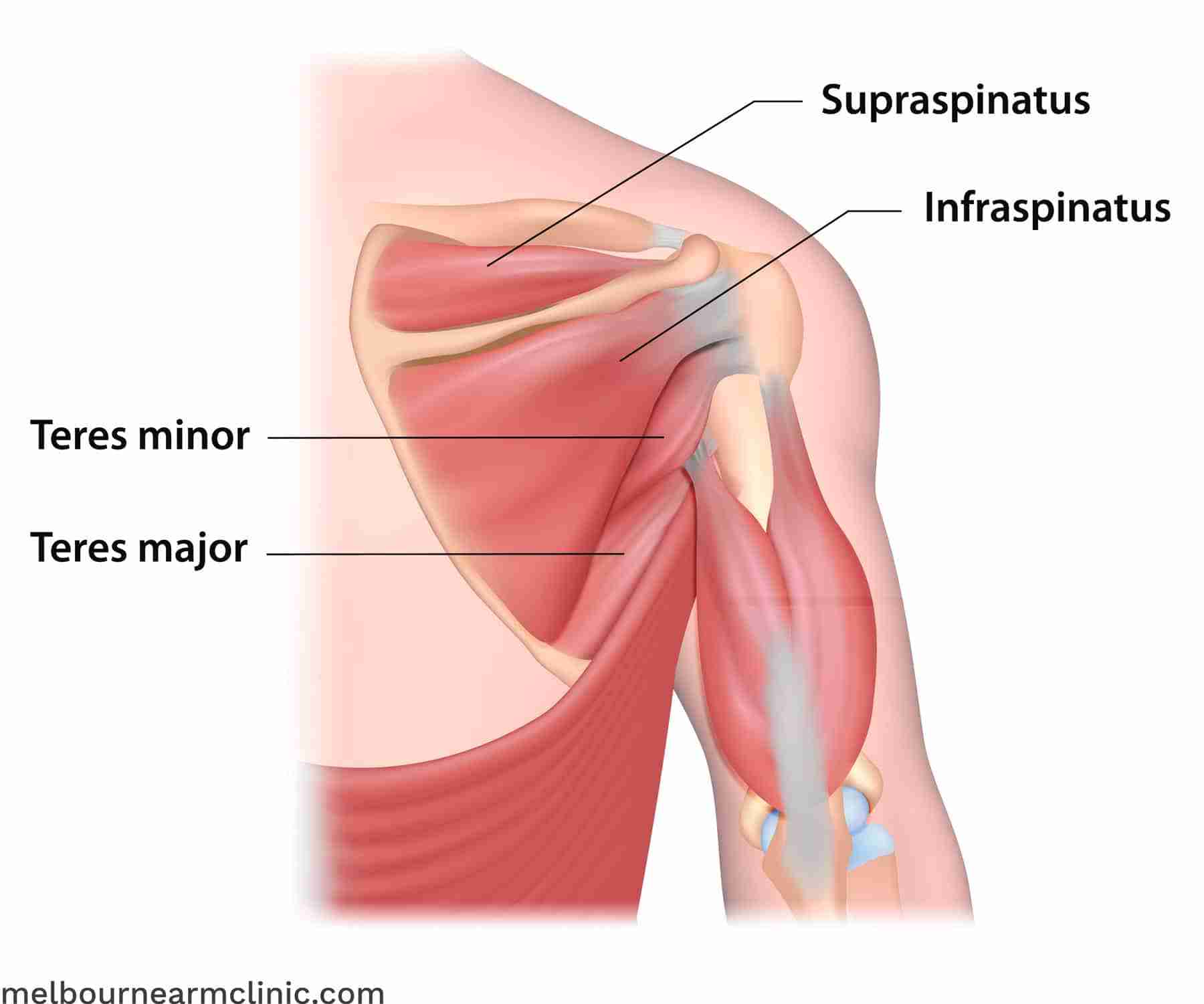 Supraspinatustendinitt | behandling og diagnose