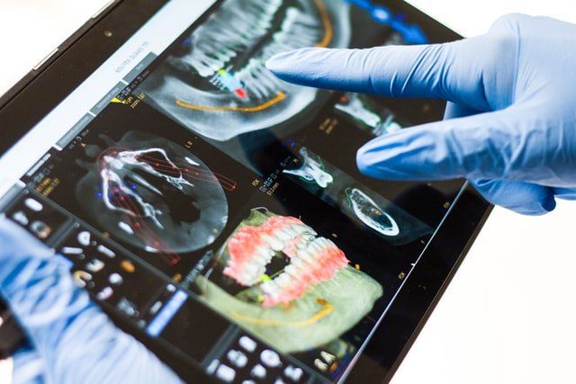 Dental graphics