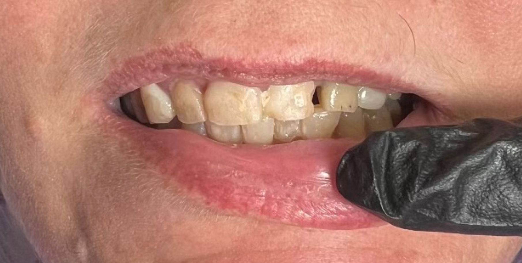 A close up of a person 's mouth with a black glove on.