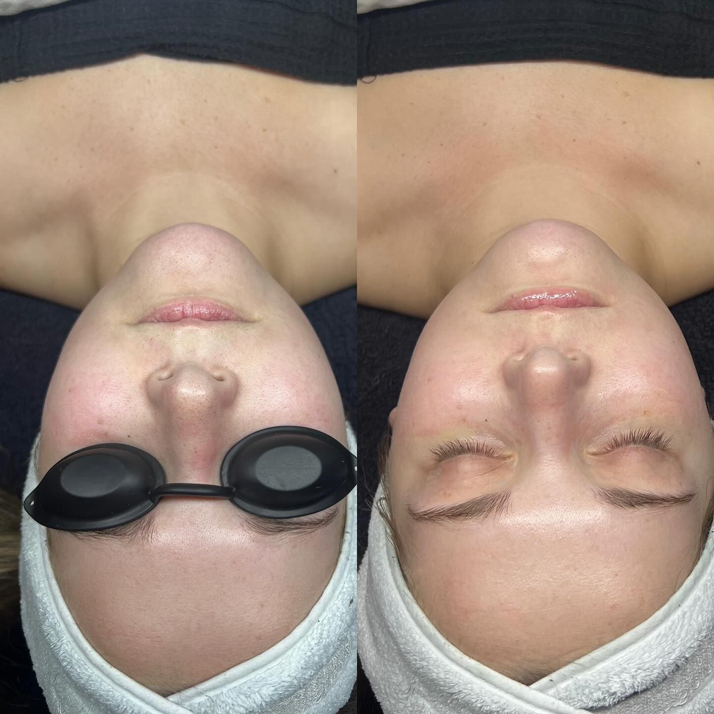 A before and after picture of a person 's face.
