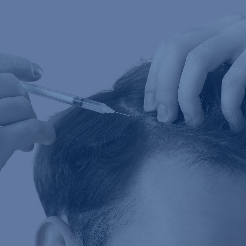 Blue-tinted close-up of a person receiving an injection into their scalp.