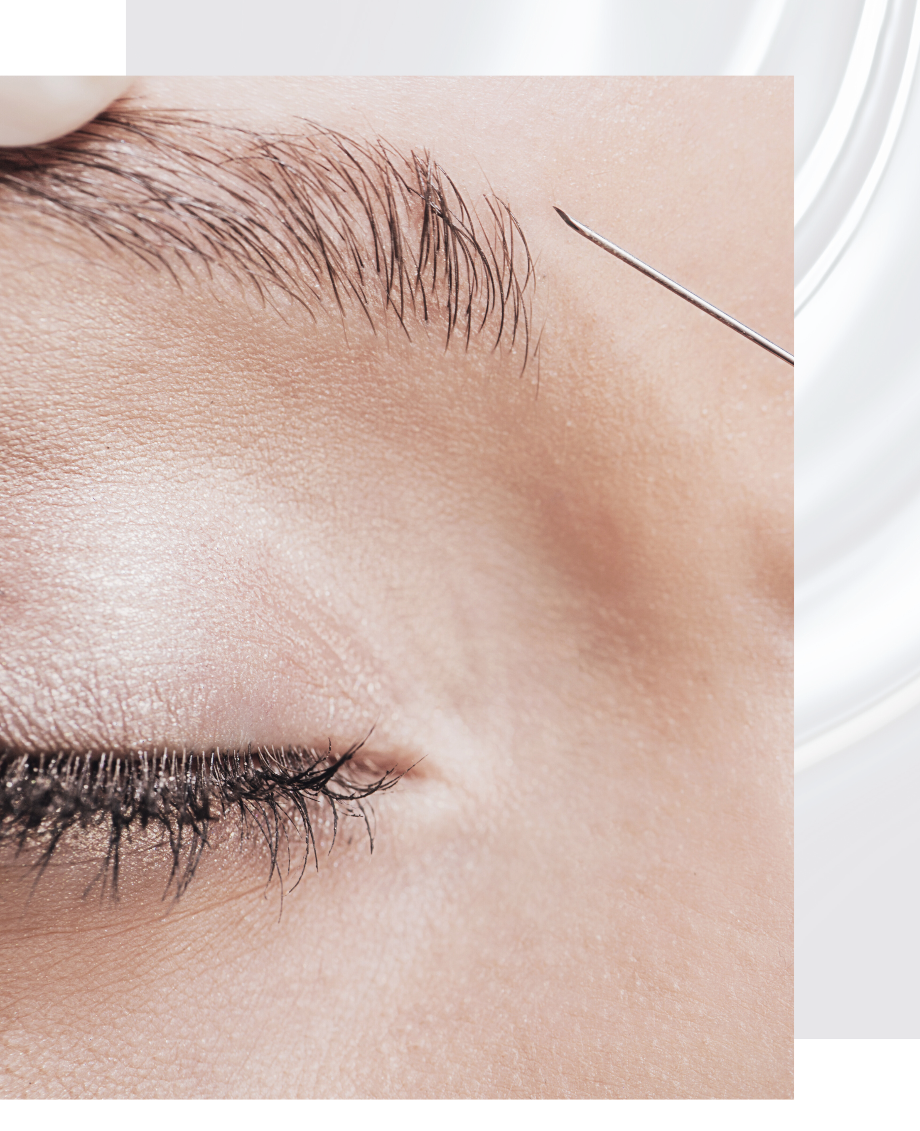Botox behandeling van de frons