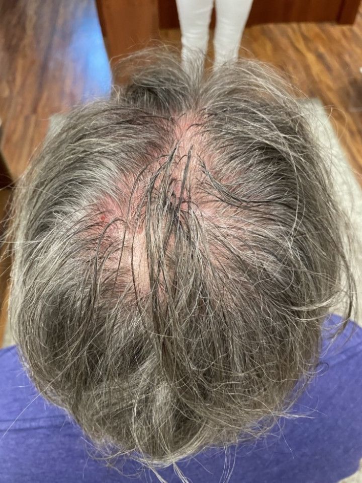 The back of a man 's head with a lot of hair.